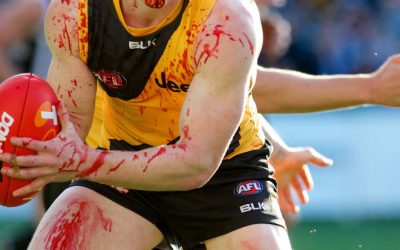 Repeated head injuries in Australia’s collision sports highlight ethical and evidential gaps in concussion management policies
