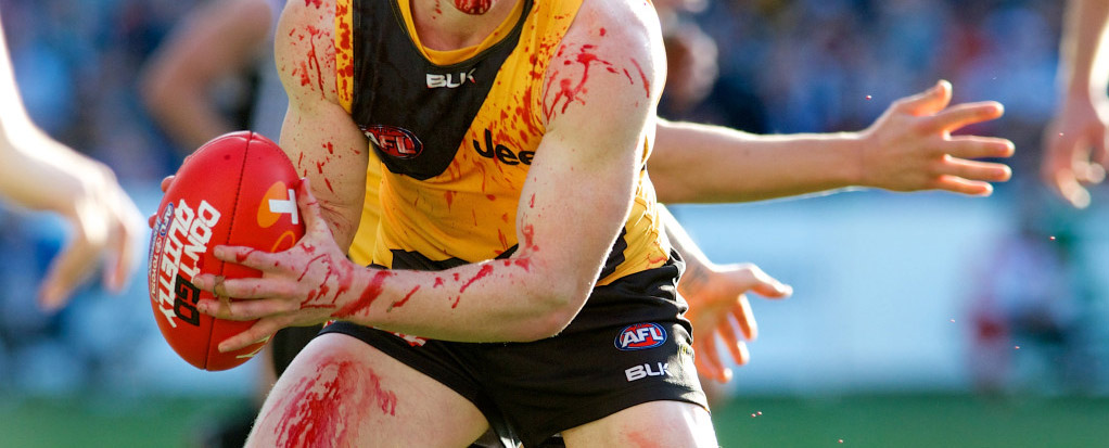 Repeated head injuries in Australia’s collision sports highlight ethical and evidential gaps in concussion management policies