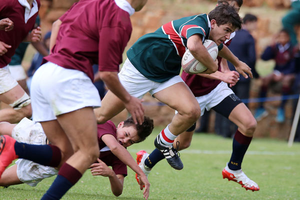 Sport Concussion and Neurodegeneration